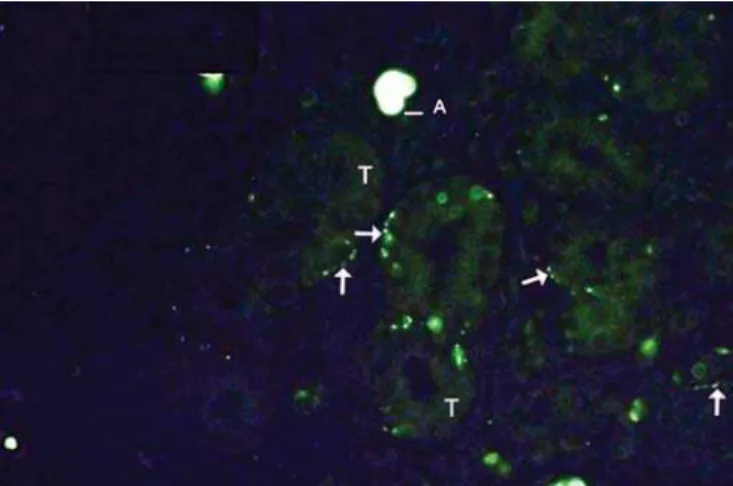 Figure 4. Examples of labeling grade 4. Many fibers (arrows), and it is possible to follow their pathway intertwined with glandular structures.