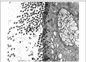Figure 4. Slide with frog palate epithelium from group 1 showing cilia at transversal section and mucous contained in mucous cell (transmission electron microscopy, 800 times magnified).