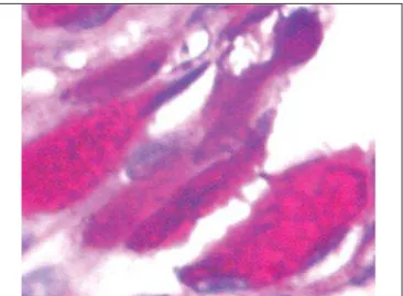 Figure 7. Slide with frog palate epithelium from group 5 showing disorganization of epithelium and increase in volume of extruded mucus (light microscopy, PAS-AB staining, 100 times magnified)