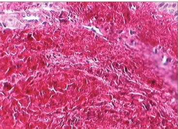 Figure 2. Vocal fold dyed by the Sirius Red solution after polarization. 