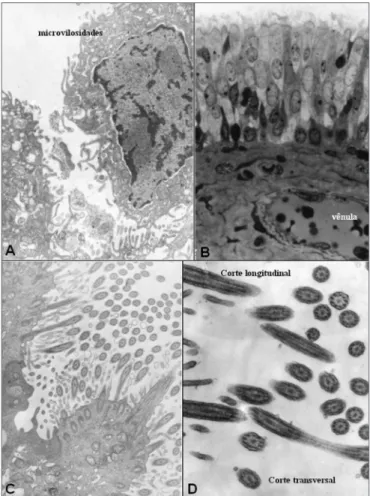 Figure  6.  Frequency  of  different  types  of  epithelium  found  in  the  groups.