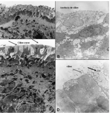 Figure 10. Group B - A: LM: non-ciliary cylindrical stratified epithelium,  with arrows showing transition areas to cuboidal epithelium (63X)