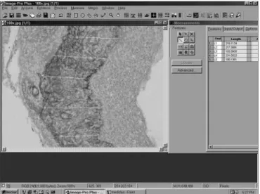 Figure 2. Image of the ImagePro Plus Media Cybernetics software  screen.