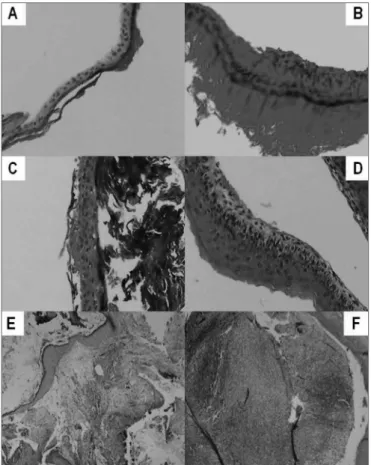 Figure 3. Digitalized image of the slide with a cholesteatoma cross- cross-section, dyed in Hematoxylin-Eosin; presenting its constituting parts: 