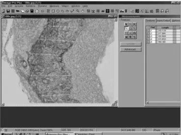 Figure  2.  Screen  image  of  ImagePro  Plus  Media  Cybernetics  sof- sof-tware.
