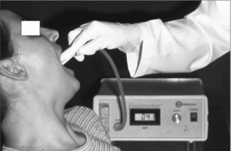 Figure 2. Halitometry Technique - Illustration of the procedure to me- me-asure VSC with the Halimeter device.