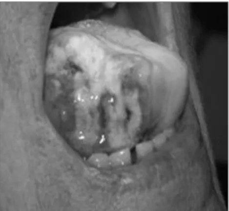 Figure 1. Tongue necrosis.