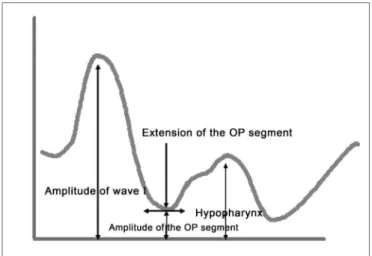 Figure 5 A - Main pharyngometric parameters 
