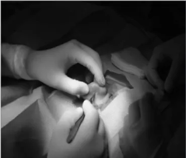 Figure 1. Preoperative