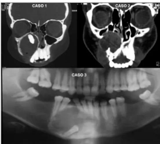 Figure 1. Radiographic aspects of cases 1, 2 and 3.