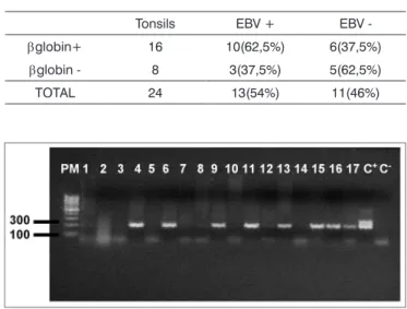 Figure 2. Agarose gel (1,7%) electrophoresis showing amplification  of the EBV genome, (209bp) PM - Molecular weight 100bp, Samples  1 - 17, C+ - DNA extracted from the line B9507, C- - Milli-Q water.