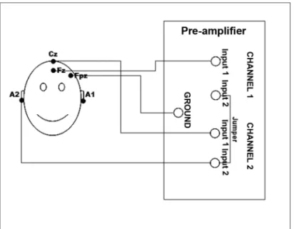 Figure 1. Illustration of the electrodes placement on a patient’s skull  according to the international 10-20 system and the cable connections  on the pre-amplifier cables of the Auditory Evoked Potentials recording  system.