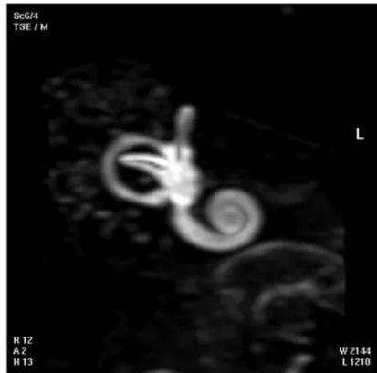 Fig. 3. 3D magnetic resonance image of case 3.