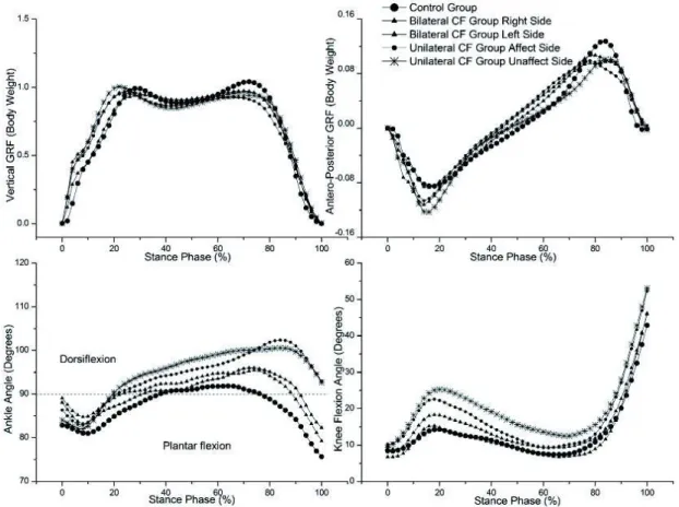 FIGURE 2 - Mean curves of biomechanical variables measured for all groups investigated during self-selected gait.