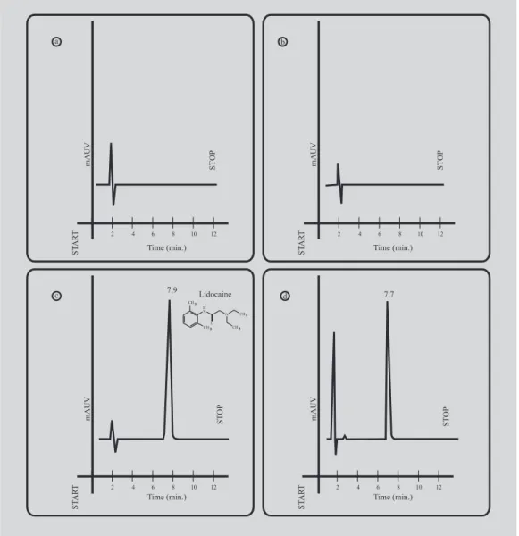 Figure 1 shows typical chromatograms of respec- respec-tively: dry methanol and dissolved in 100 µL of mobile phase, isotonic phosphate buffer pH 7.2, lidocaine hydrochloride solution 25.0 µg/mL after dry and dissolved