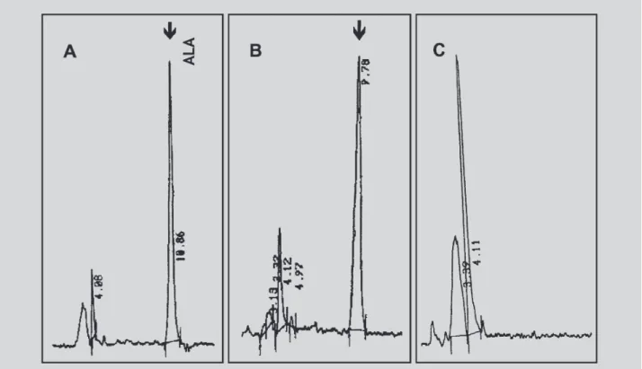 FIGURE 1 - HPLC chromatogram of ALA with fluorescence detector. (A) Chromatogram of 5-aminolevulinic acid (ALA) in standard solution (200 mg/ L, left); (B) liver homogenate + ALA (prepared at 200 mg/ L, middle); (C) liver sample from rats treated with HCB 