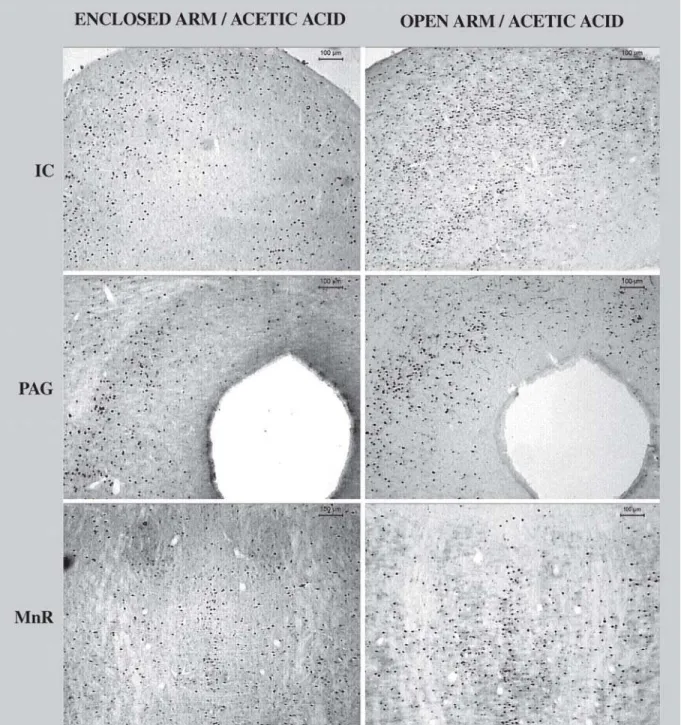 FIGURE 1 - Photomicrographs of Fos-like immunoreactivity in coronal sections through brain regions with significant increase in Fos expression