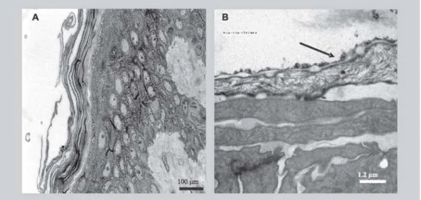 FIGURE 2 - (A) Light microscope micrograph of human epidermis after 24h papain treatment