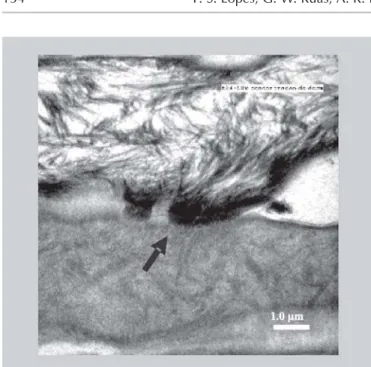FIGURE 3 - Transmission electron micrograph of human skin after treatment during 24 hours using papain 0.2% (p/