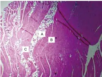 Figure 4 – Normal muscle tissue (A) and PMMA (B)  surrounded by ibrous connective tissue with mild inlammatory 