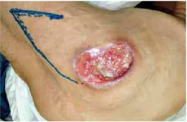 Figure 25 – The one-month postoperative period  of the patient shown in Figures 22 to 24.