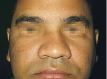 Figure 14 – Case 2. Postoperative period: frontal view.
