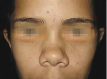 Figure 17 – Case 4. Preoperative period: frontal view.