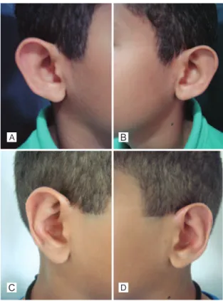 Figure 14 – Patient 2. A, preoperative image, anterior view;  