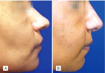 Figure 12 – Patient 6. In A, preoperative period.  