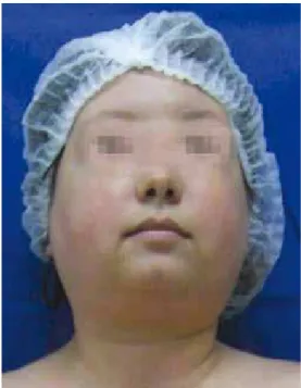 Figure 3 – Cervical region: preoperative.
