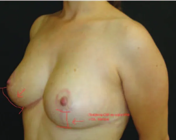 Figure 2  –  A, preoperative period. 