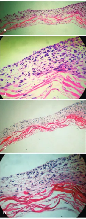 Figure 1  – Light microscopic image of the  collagen  matrix of porcine intestinal submucosa (OASIS ® ) 