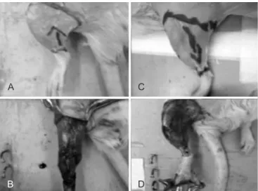 Figure 1 – In A and B, lap with pedicle of proximal low (G1). 