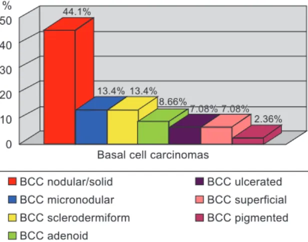 Figure 2 – Distribution of squamous cell carcinomas   according to Broders’ classiication.