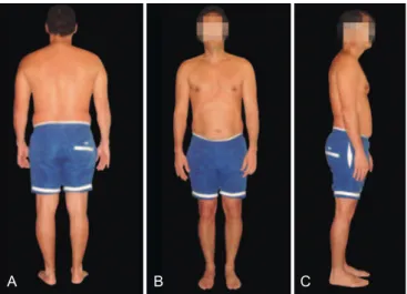 Figure 1  – Postural analysis of the control group (CO),  in posterior (A), anterior (B) and right lateral (C)  views.