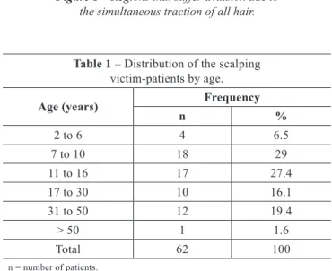 Figure 1  – Regions that suffer avulsion due to   the simultaneous traction of all hair