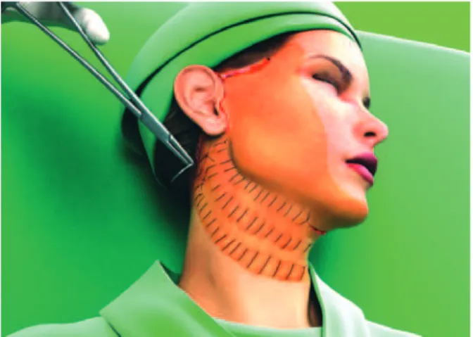 Figure 4 – The whole hemiface with the  hemostatic net in place.