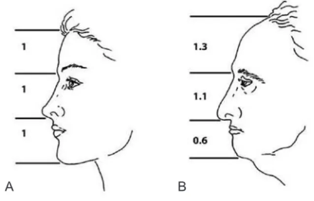 Figure 1 – For a proportional face, the height of the forehead  should correspond to one-third of the total facial height