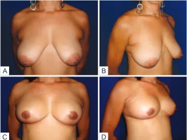 Figure 12 – Patient 1. In A , Preoperative view, frontal position. 