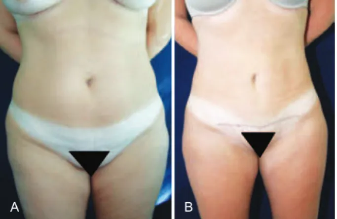 Figure 9 – In A, Preoperative appearance.  