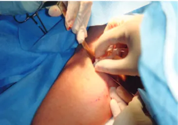 Figure 10 – In A and B, preoperative images.  