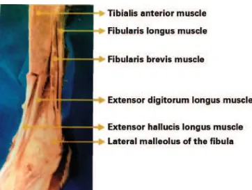 Figure 2  – Presence of the ibularis tertius muscle  in the lower limb.