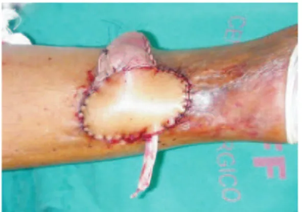 Figure 10  – Details that should be addressed when the patient is  placed in the supine position