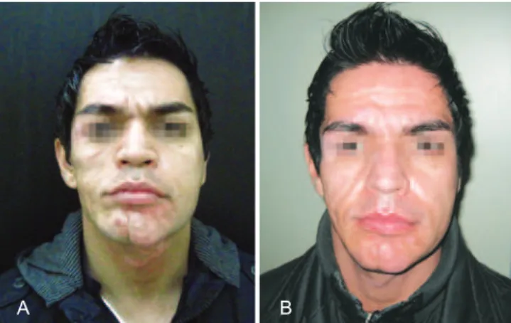 Figure 2 – In A, patient before the beginning of aesthetic treatment. 