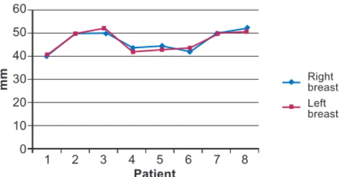 Figure 11 – Horizontal diameter of the areola in   bilateral mammary reconstructions.