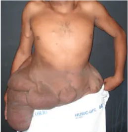 Figure 1  – Preoperative appearance, anterior view.