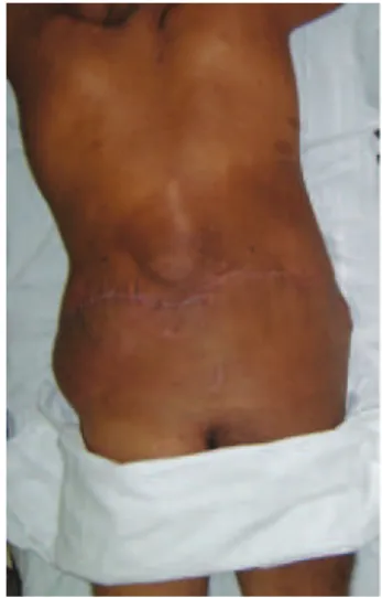 Figure 7  – Postoperative appearance, anterior view. 