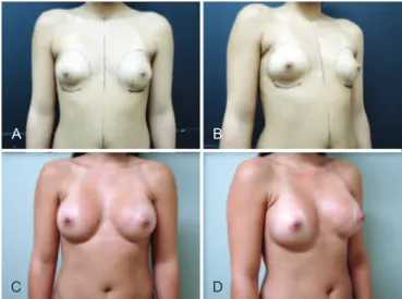 Figure 2 – Case 1. A 25-year-old patient.  