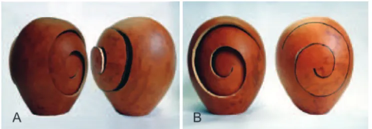 Figure 1 - Representation of the shape of the osteotomy   and its possibilities for expansion (A) or contraction (B) using the 