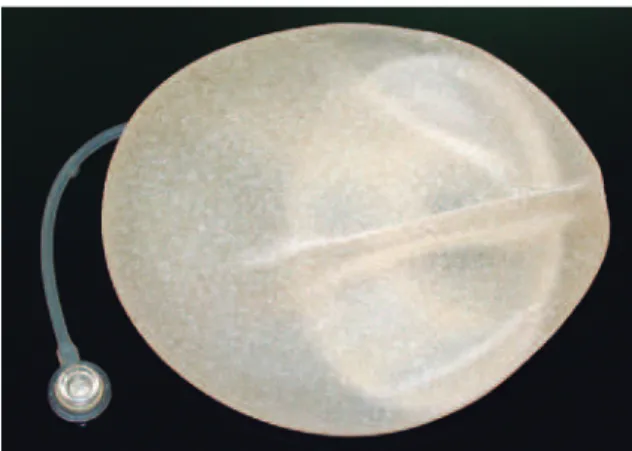 Figure 1 – The deinitive expander implant,   a biodimensional anatomical implant.